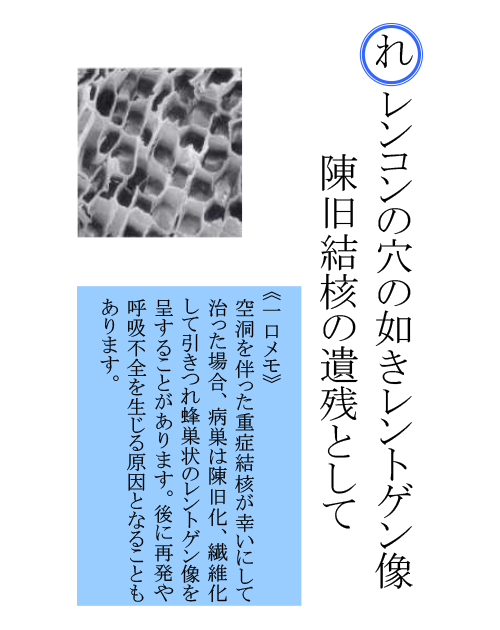 結核いろはカルタ | 日本結核・非結核性抗酸菌症学会 結核いろはカルタ | 日本結核・非結核性抗酸菌症学会